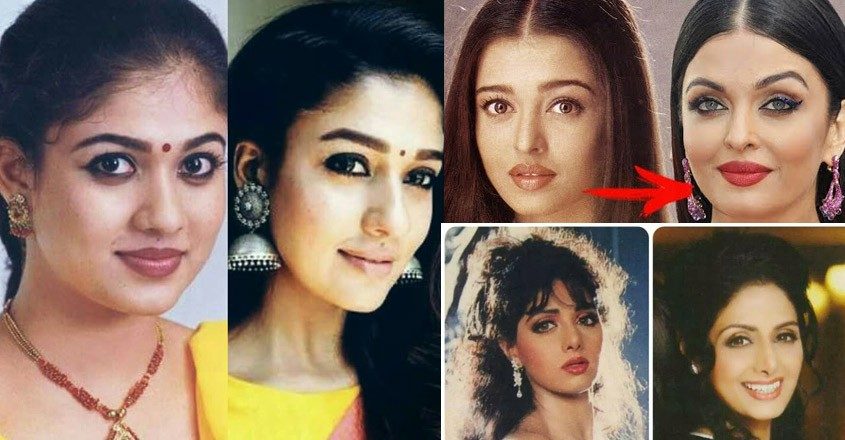 Check out how plastic surgery transformed these actresses